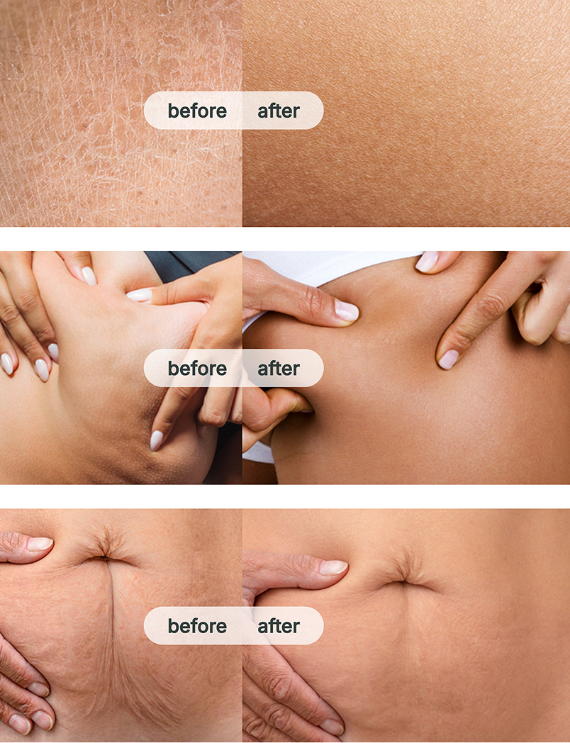 Woman Skin - Before and After