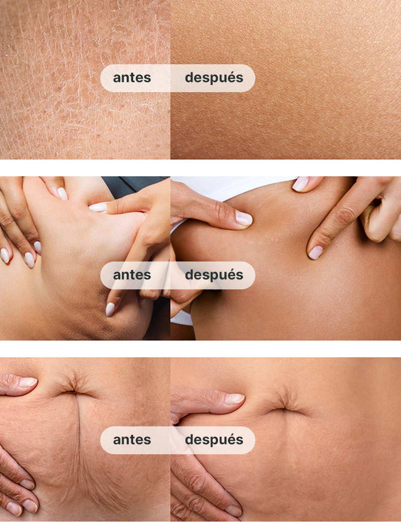 Woman Skin - Before and After