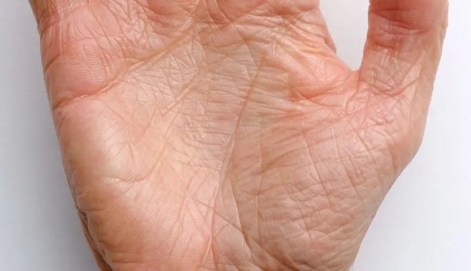 Wrinkled Hand